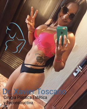 Slider image (3) Dr. Xavier Toscano - Plastic Surgeon